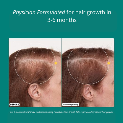 ElveraLabs©  Hair Growth Tabs